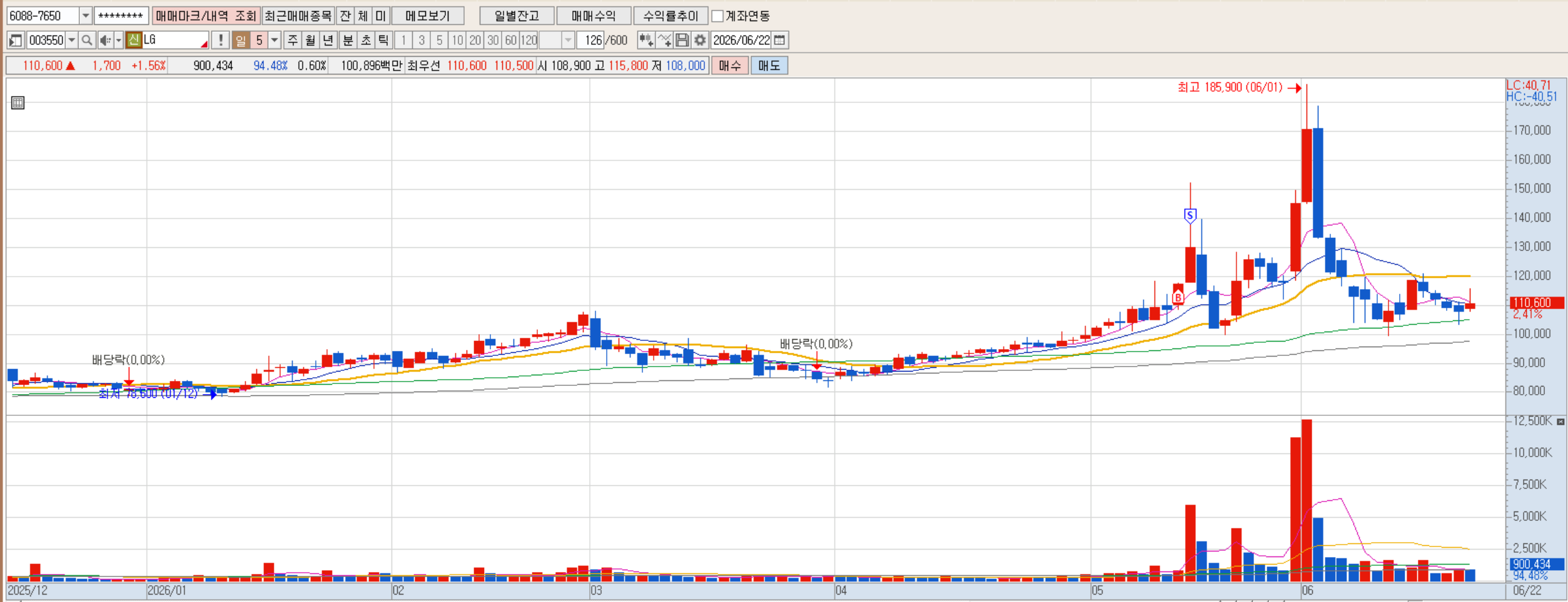 LG 매매기록차트